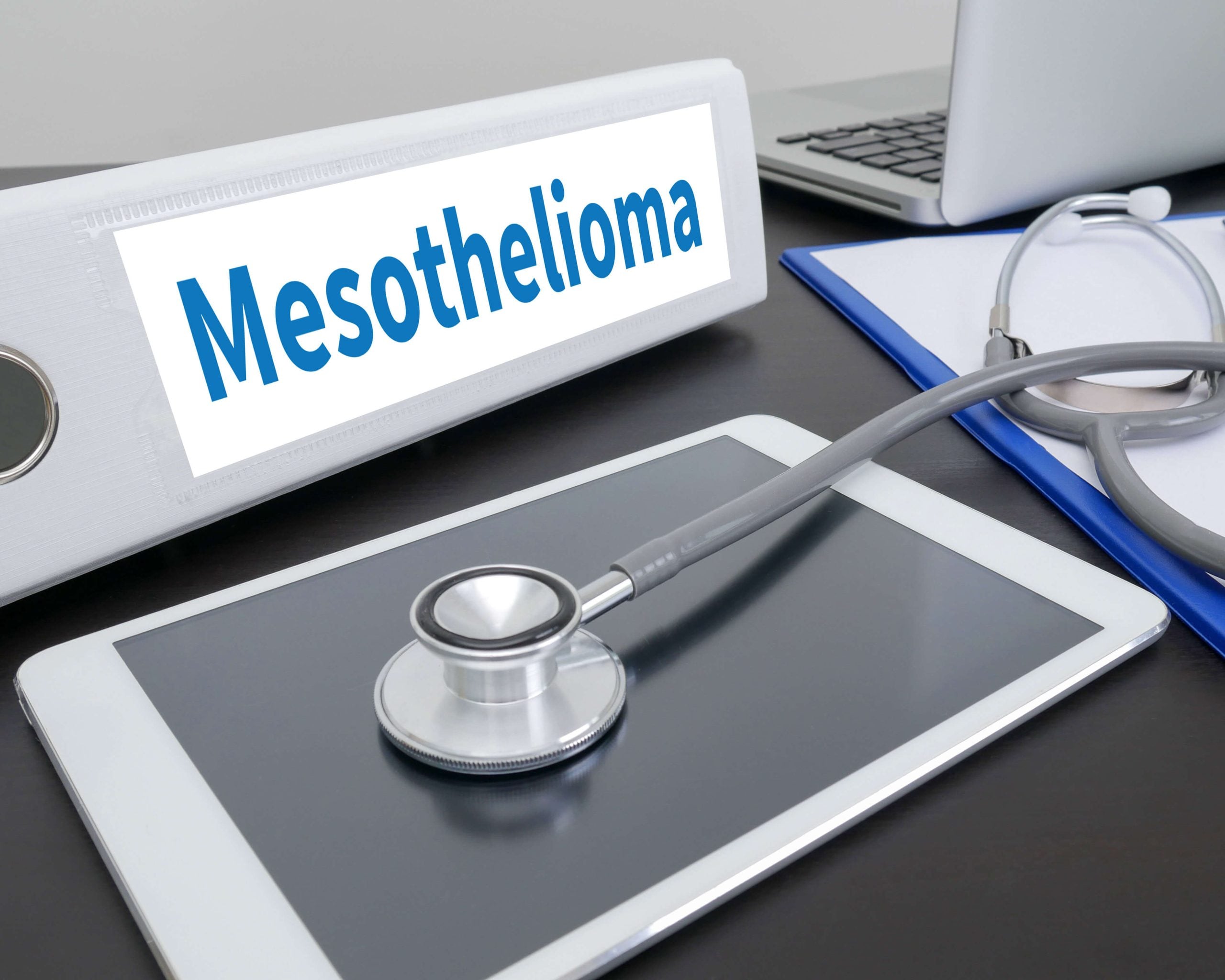 Stages-of-Mesothelioma in Jackson